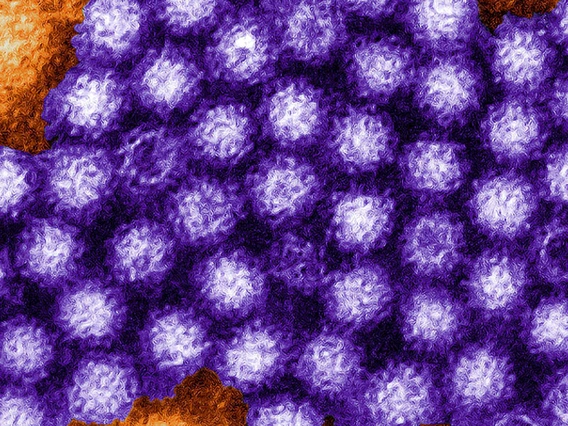 Purple norovirus microbes viewed through a microscope